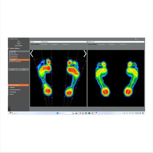 Програмне забезпечення для біомеханічного аналізу freeStep PRO 2484 фото