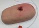 Тренажер для тампонади (комплект - вогнепальна рана) 202520 фото 3